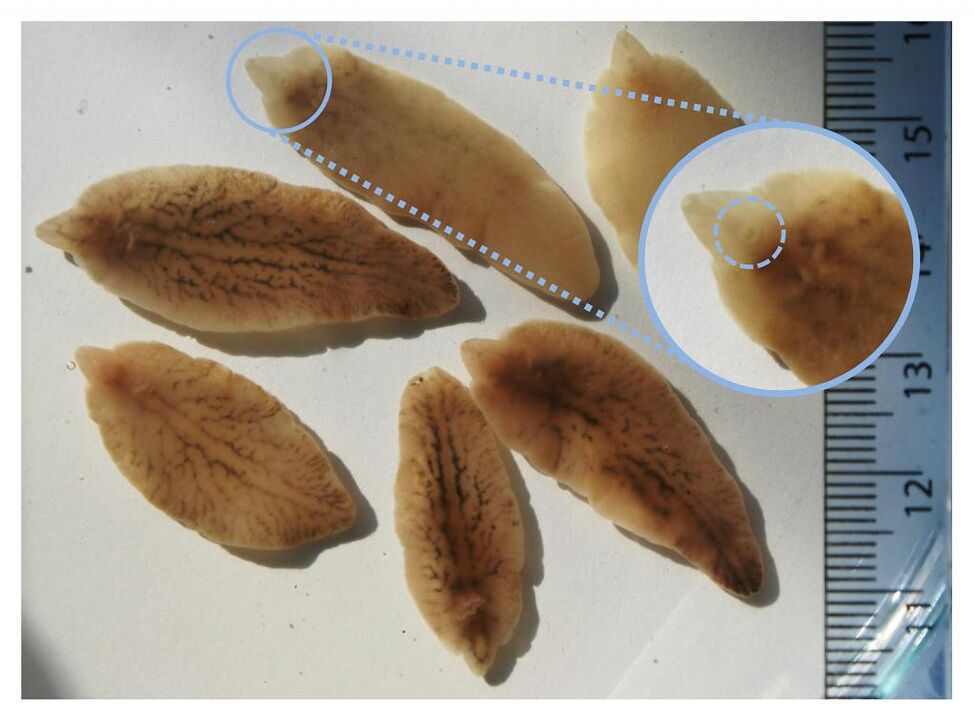 trematodos hepáticos