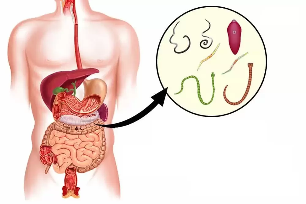 Los gusanos son parásitos en el intestino humano. 