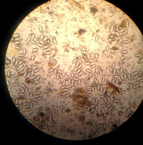 El oxiuro es un nematodo parásito y de vida libre. 