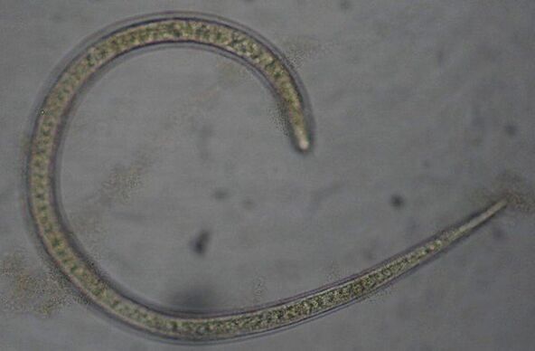 Trichinella es un gusano parásito redondo protóstoma
