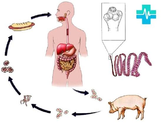 Formas de infección